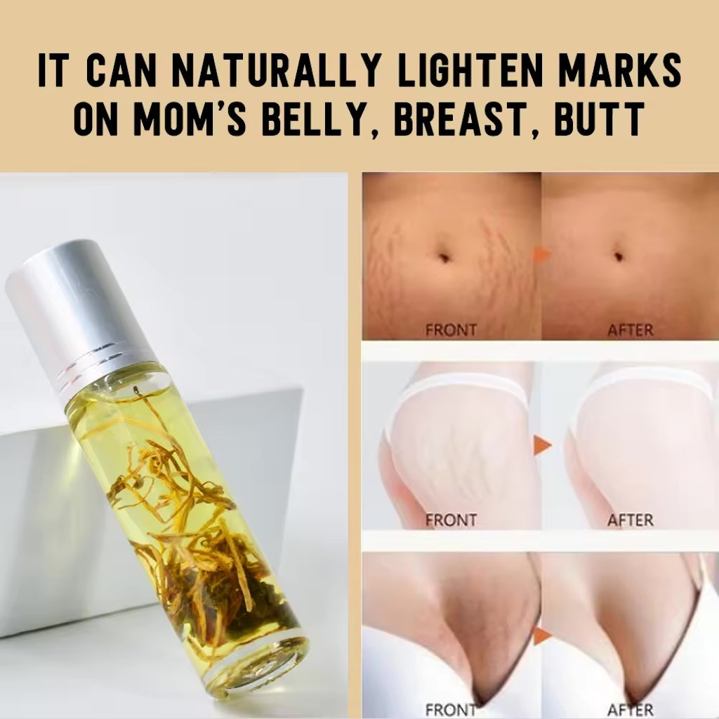 Serum for Scars & Stretch Marks w/ Organic Jojoba Oil & Vitamin E - .34 oz for 2