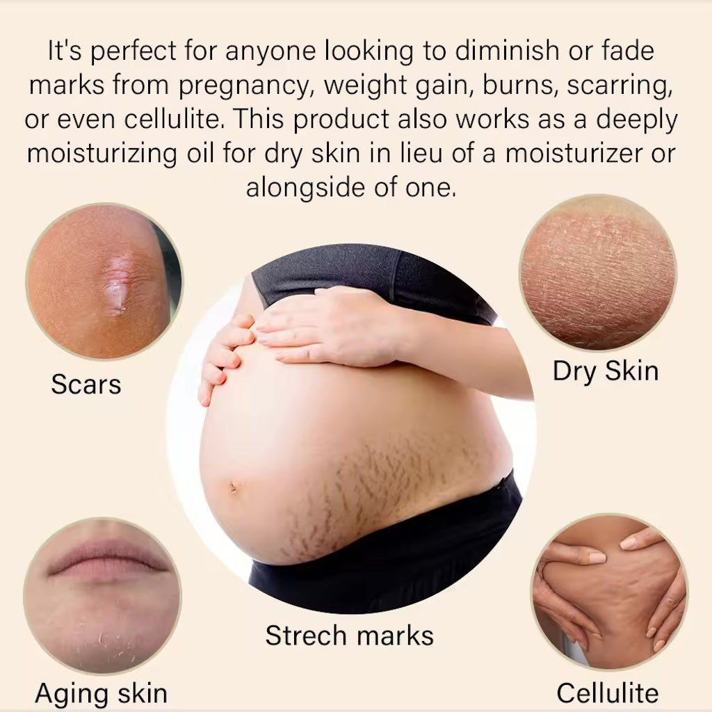 Serum for Scars & Stretch Marks w/ Organic Jojoba Oil & Vitamin E - .34 oz for 2