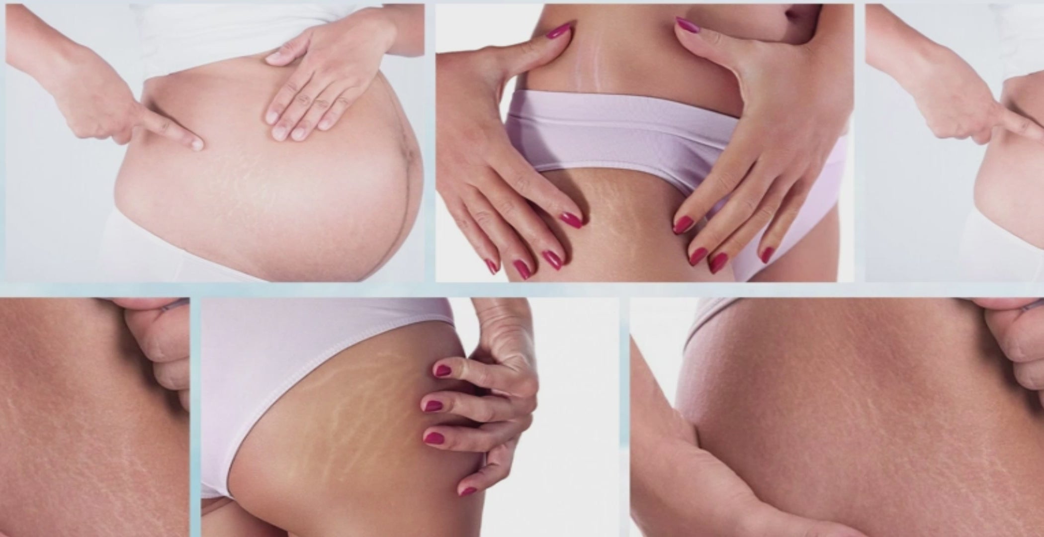 Serum for Scars & Stretch Marks w/ Organic Jojoba Oil & Vitamin E - .34 oz for 2